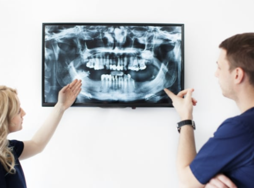 Preventive Measure To Be Taken Before Teeth X-ray